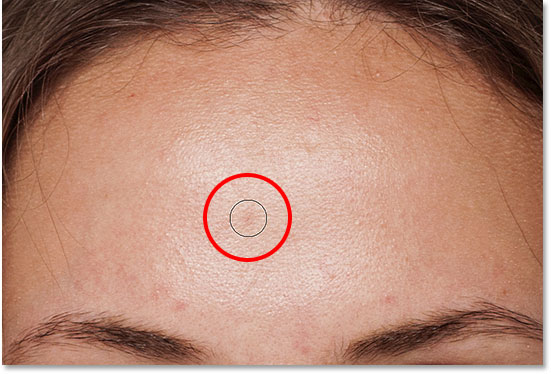 Positioning the Spot Healing Brush over a second skin blemish to heal it